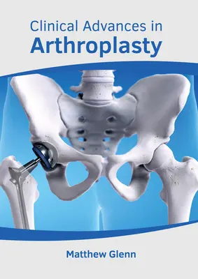 Postępy kliniczne w artroplastyce - Clinical Advances in Arthroplasty