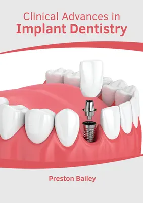 Postępy kliniczne w stomatologii implantologicznej - Clinical Advances in Implant Dentistry