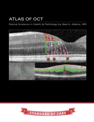 Atlas OCT: Anatomia siatkówki w zdrowiu i patologii - Atlas of OCT: Retinal Anatomy in Health & Pathology