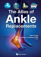 Atlas protez stawu skokowego - The Atlas of Ankle Replacements