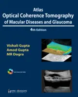 Atlas optycznej koherentnej tomografii chorób plamki żółtej i jaskry - Atlas Optical Coherence Tomography of Macular Diseases and Glaucoma