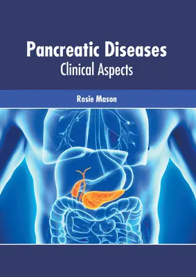 Choroby trzustki: Aspekty kliniczne - Pancreatic Diseases: Clinical Aspects