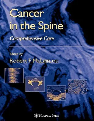 Rak kręgosłupa: Kompleksowa opieka - Cancer in the Spine: Comprehensive Care