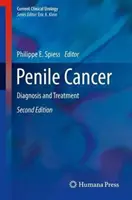 Rak prącia: Diagnostyka i leczenie - Penile Cancer: Diagnosis and Treatment