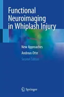 Neuroobrazowanie funkcjonalne w urazach kręgosłupa szyjnego - nowe podejścia - Functional Neuroimaging in Whiplash Injury - New Approaches