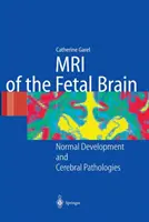 MRI mózgu płodu: Prawidłowy rozwój i patologie mózgu - MRI of the Fetal Brain: Normal Development and Cerebral Pathologies