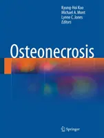 Osteonekroza - Osteonecrosis