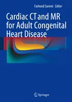 Tomografia komputerowa i rezonans magnetyczny serca w leczeniu wrodzonych wad serca u dorosłych - Cardiac CT and MR for Adult Congenital Heart Disease