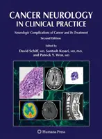 Neurologia nowotworów w praktyce klinicznej: Neurologiczne powikłania raka i ich leczenie - Cancer Neurology in Clinical Practice: Neurologic Complications of Cancer and Its Treatment