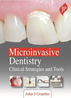 Stomatologia mikroinwazyjna - strategie i narzędzia kliniczne - Microinvasive Dentistry - Clinical Strategies and Tools