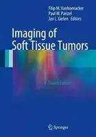Obrazowanie guzów tkanek miękkich - Imaging of Soft Tissue Tumors