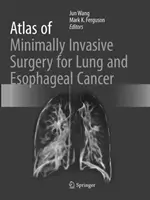 Atlas minimalnie inwazyjnej chirurgii raka płuc i przełyku - Atlas of Minimally Invasive Surgery for Lung and Esophageal Cancer