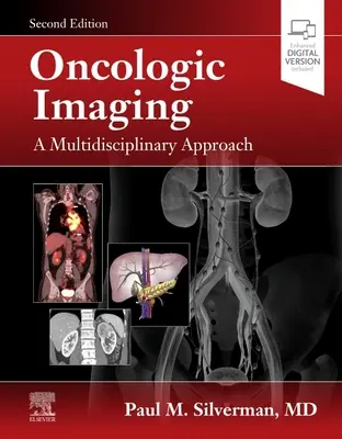 Obrazowanie onkologiczne: Multidyscyplinarne podejście - Oncologic Imaging: A Multidisciplinary Approach