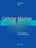 Ablacja przezcewnikowa: Aktualne podejście do arytmii serca - Catheter Ablation: A Current Approach on Cardiac Arrhythmias