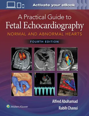 Praktyczny przewodnik po echokardiografii płodu: Normalne i nieprawidłowe serca - A Practical Guide to Fetal Echocardiography: Normal and Abnormal Hearts