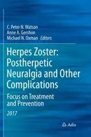 Herpes Zoster: Neuralgia popółpaścowa i inne powikłania: Koncentracja na leczeniu i zapobieganiu - Herpes Zoster: Postherpetic Neuralgia and Other Complications: Focus on Treatment and Prevention