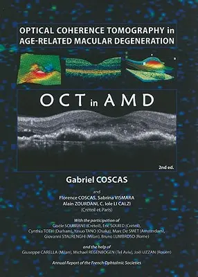 Optyczna tomografia koherencyjna w zwyrodnieniu plamki żółtej związanym z wiekiem - Optical Coherence Tomography in Age-Related Macular Degeneration