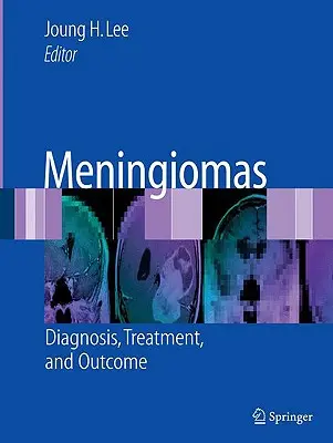 Oponiaki: Diagnoza, leczenie i wyniki - Meningiomas: Diagnosis, Treatment, and Outcome