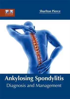 Zesztywniające zapalenie stawów kręgosłupa: Diagnostyka i leczenie - Ankylosing Spondylitis: Diagnosis and Management