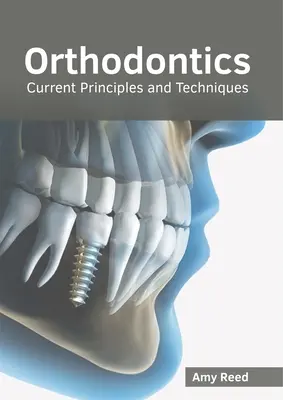 Ortodoncja: Aktualne zasady i techniki - Orthodontics: Current Principles and Techniques