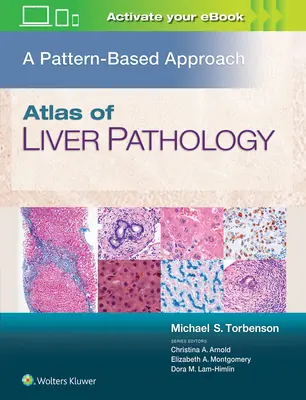 Atlas patologii wątroby: Podejście oparte na wzorcach - Atlas of Liver Pathology: A Pattern-Based Approach