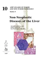 Nienowotworowe choroby wątroby - Non-Neoplastic Diseases of the Liver