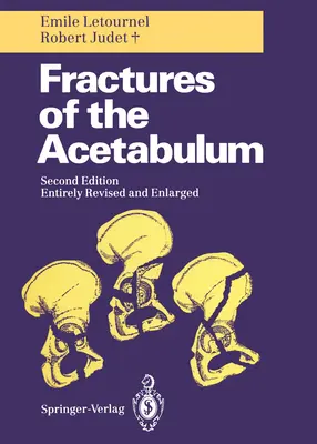 Złamania panewki stawowej - Fractures of the Acetabulum