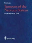 Nowotwory układu nerwowego: Atlas ultrastrukturalny - Tumours of the Nervous System: An Ultrastructural Atlas