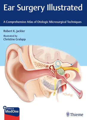 Ilustrowana chirurgia ucha: Kompleksowy atlas otologicznych technik mikrochirurgicznych - Ear Surgery Illustrated: A Comprehensive Atlas of Otologic Microsurgical Techniques