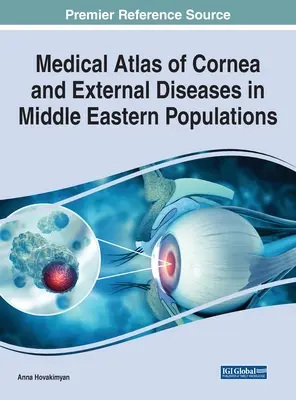 Atlas medyczny rogówki i chorób zewnętrznych w populacjach Bliskiego Wschodu - Medical Atlas of Cornea and External Diseases in Middle Eastern Populations