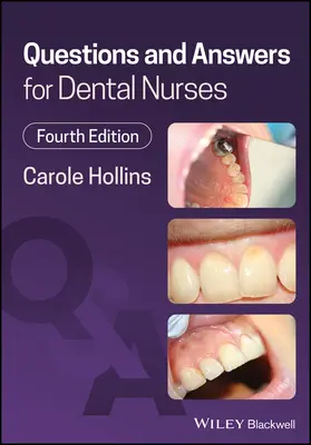 Pytania i odpowiedzi dla pielęgniarek dentystycznych - Questions and Answers for Dental Nurses