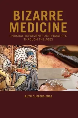Dziwaczna medycyna: Niezwykłe zabiegi i praktyki na przestrzeni wieków - Bizarre Medicine: Unusual Treatments and Practices through the Ages