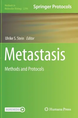 Przerzuty: Metody i protokoły - Metastasis: Methods and Protocols
