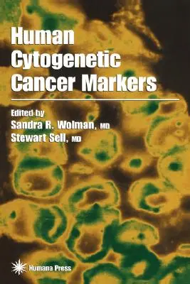 Ludzkie cytogenetyczne markery nowotworowe - Human Cytogenetic Cancer Markers