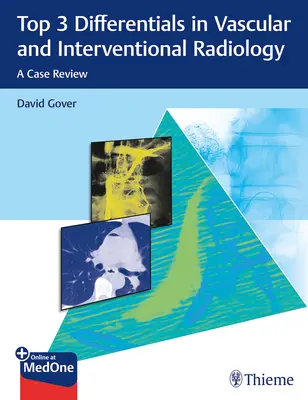 3 najważniejsze różnice w radiologii naczyniowej i interwencyjnej: Przegląd przypadków - Top 3 Differentials in Vascular and Interventional Radiology: A Case Review