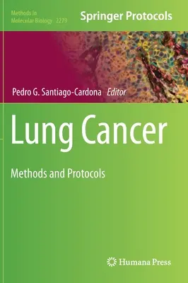 Rak płuc: Metody i protokoły - Lung Cancer: Methods and Protocols