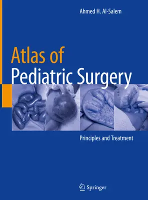 Atlas chirurgii dziecięcej: Zasady i leczenie - Atlas of Pediatric Surgery: Principles and Treatment