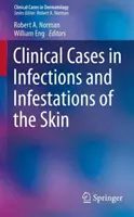 Przypadki kliniczne w infekcjach i zakażeniach skóry - Clinical Cases in Infections and Infestations of the Skin