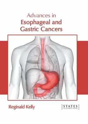 Postępy w leczeniu nowotworów przełyku i żołądka - Advances in Esophageal and Gastric Cancers