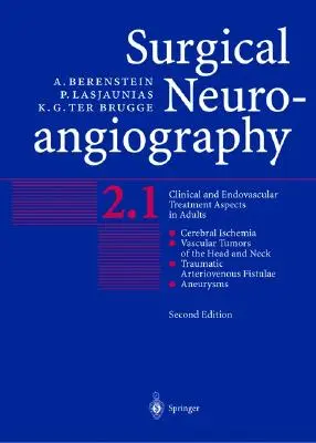 Neuroangiografia chirurgiczna: Vol.2: Aspekty leczenia klinicznego i wewnątrznaczyniowego u dorosłych - Surgical Neuroangiography: Vol.2: Clinical and Endovascular Treatment Aspects in Adults