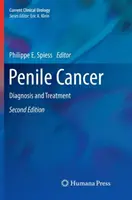 Rak prącia: Diagnostyka i leczenie - Penile Cancer: Diagnosis and Treatment