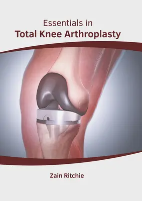 Podstawy całkowitej endoprotezoplastyki stawu kolanowego - Essentials in Total Knee Arthroplasty