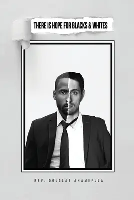 Jest nadzieja dla białych i czarnych - There Is Hope for Blacks & Whites