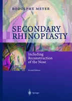 Wtórna plastyka nosa: W tym rekonstrukcja nosa - Secondary Rhinoplasty: Including Reconstruction of the Nose