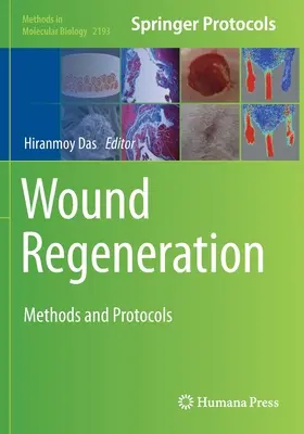 Regeneracja ran: Metody i protokoły - Wound Regeneration: Methods and Protocols