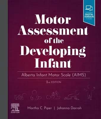 Ocena motoryczna rozwijającego się niemowlęcia - Alberta Infant Motor Scale - Motor Assessment of the Developing Infant - Alberta Infant Motor Scale