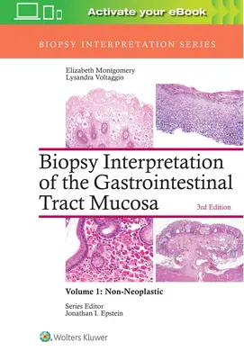 Interpretacja biopsji błony śluzowej przewodu pokarmowego: Tom 1: Nienowotworowe - Biopsy Interpretation of the Gastrointestinal Tract Mucosa: Volume 1: Non-Neoplastic