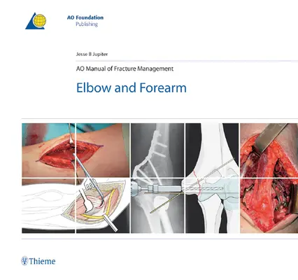 Ao Podręcznik leczenia złamań - łokieć i przedramię - Ao Manual of Fracture Management - Elbow & Forearm
