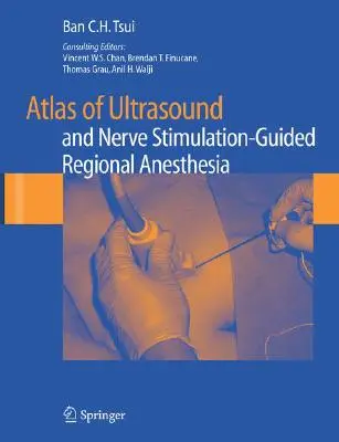 Atlas znieczulenia regionalnego sterowanego ultradźwiękami i stymulacją nerwów - Atlas of Ultrasound and Nerve Stimulation-Guided Regional Anesthesia