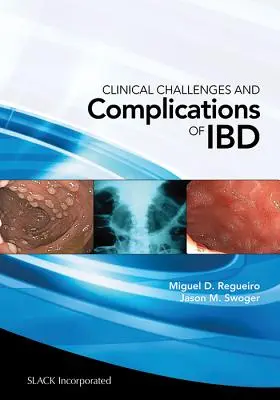 Wyzwania kliniczne i powikłania choroby Ibd - Clinical Challenges and Complications of Ibd